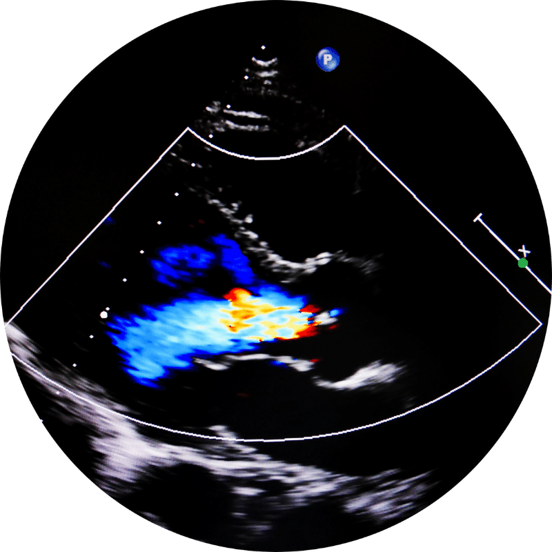 Mobile Ultrasound and Diagnostic Services by Sacramento Imaging
