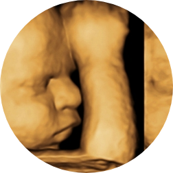 baby-ultrasound-sacramento-imaging